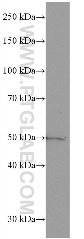 Western Blot (WB) analysis of human skeletal muscle tissue using GLUT4 Monoclonal antibody (66846-1-Ig)