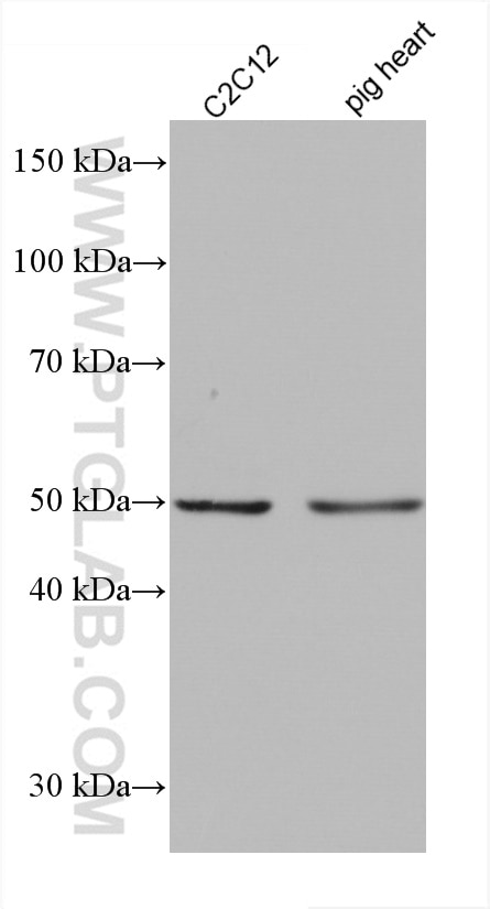 Western Blot (WB) analysis of various lysates using GLUT4 Monoclonal antibody (66846-1-Ig)