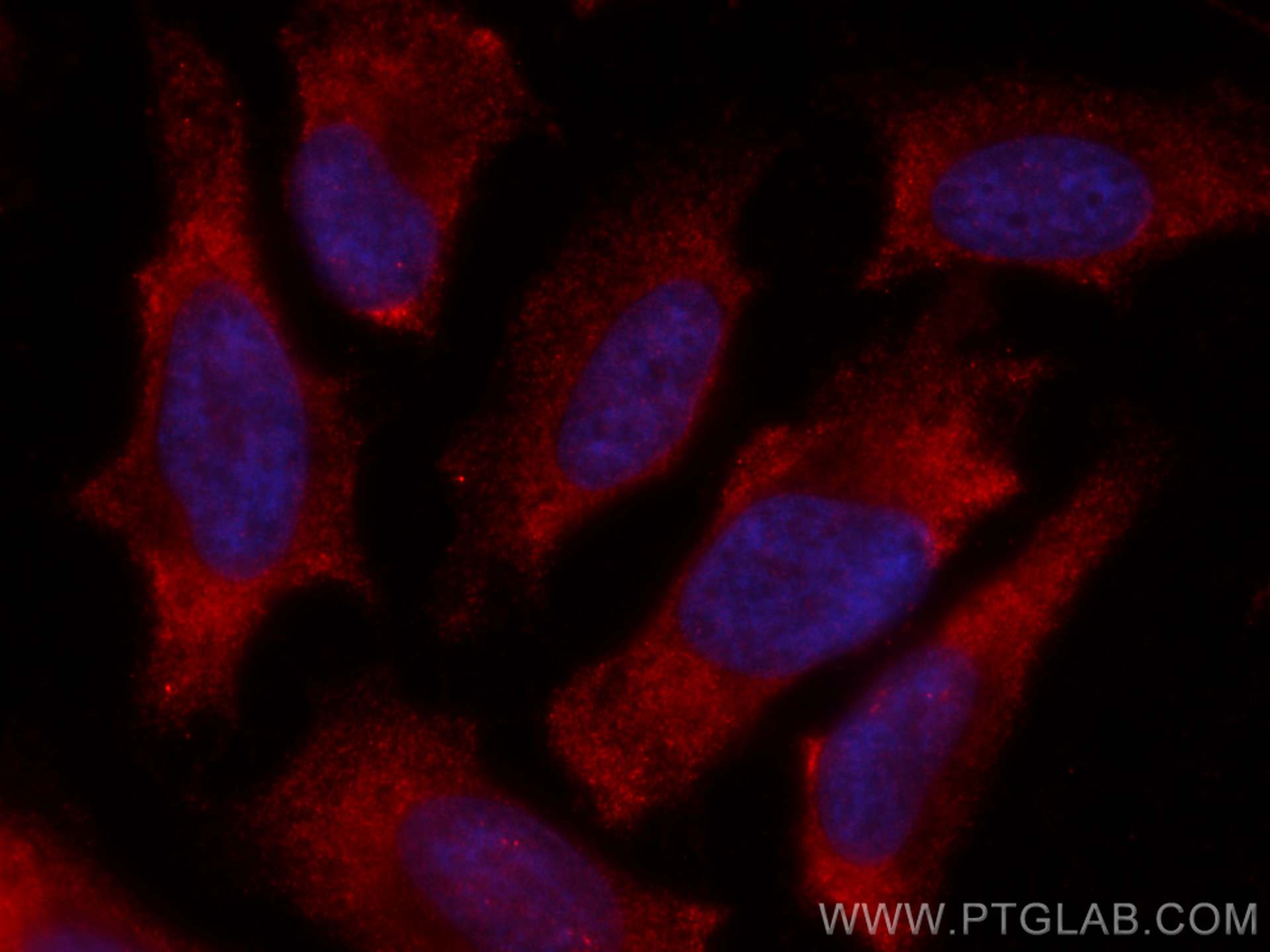 Immunofluorescence (IF) / fluorescent staining of HeLa cells using CoraLite®594-conjugated GLUT4 Monoclonal antibody (CL594-66846)