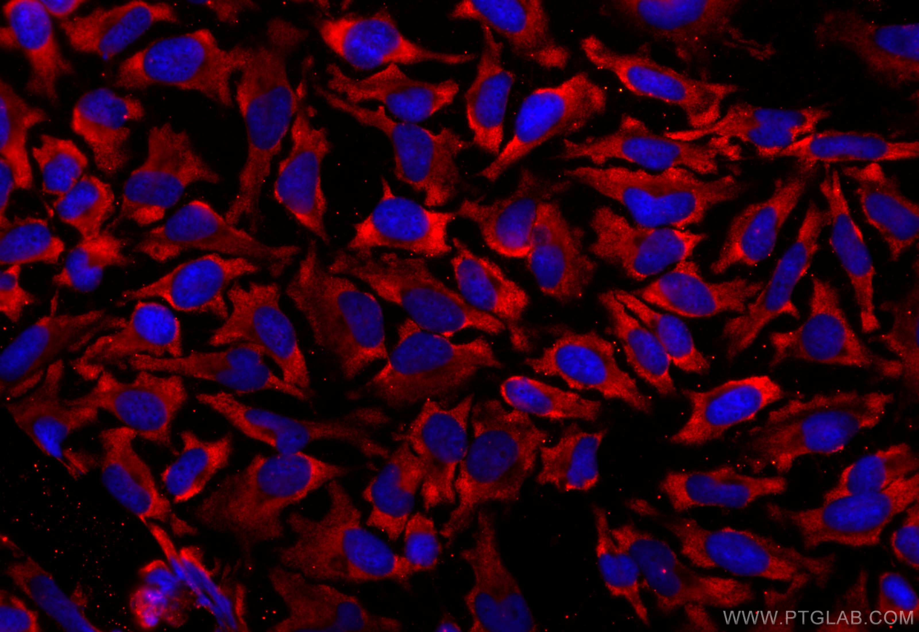 Immunofluorescence (IF) / fluorescent staining of HeLa cells using CoraLite®594-conjugated GLUT4 Monoclonal antibody (CL594-66846)