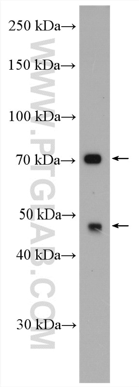 Western Blot (WB) analysis of mouse brain tissue using GLUT5 Polyclonal antibody (27571-1-AP)