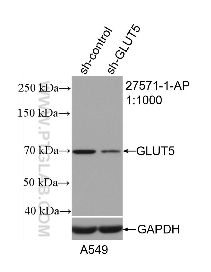 Western Blot (WB) analysis of A549 cells using GLUT5 Polyclonal antibody (27571-1-AP)