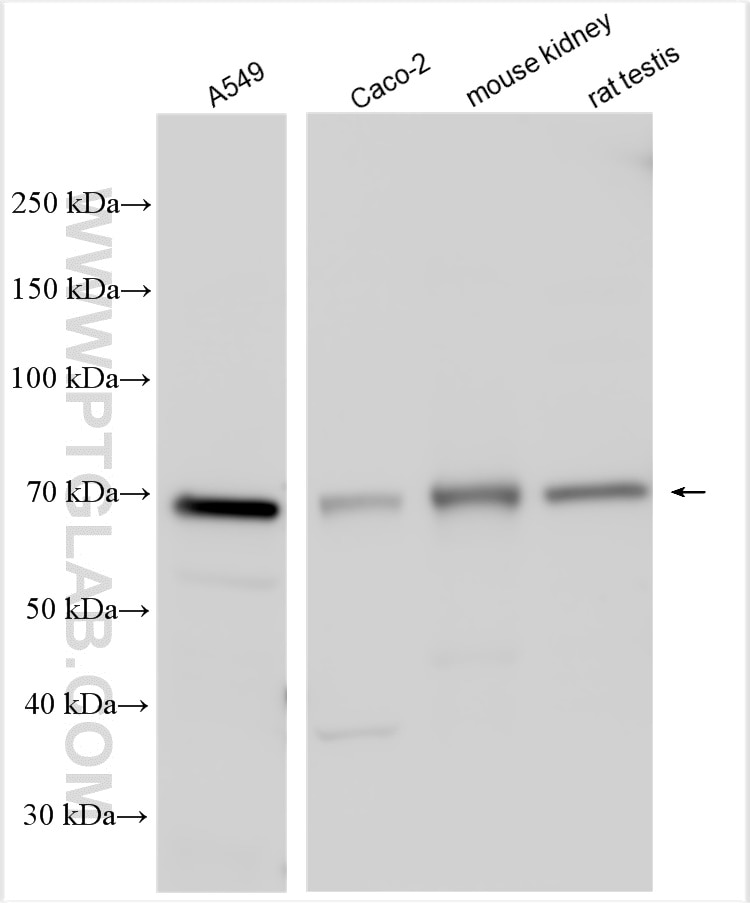 Western Blot (WB) analysis of various lysates using GLUT5 Polyclonal antibody (27571-1-AP)