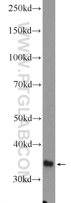 Western Blot (WB) analysis of mouse liver tissue using GLYAT Polyclonal antibody (10900-1-AP)