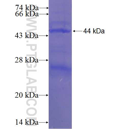 GLYAT fusion protein Ag1351 SDS-PAGE