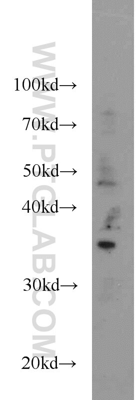 Western Blot (WB) analysis of mouse liver tissue using GLYATL1 Polyclonal antibody (15717-1-AP)