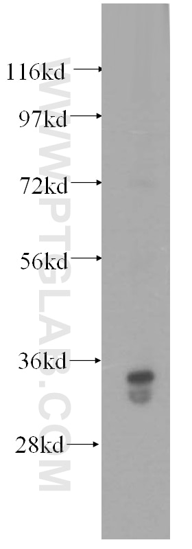 Western Blot (WB) analysis of human liver tissue using GLYATL1 Polyclonal antibody (15717-1-AP)