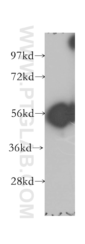 Western Blot (WB) analysis of human lung tissue using GLYCTK Polyclonal antibody (12426-1-AP)