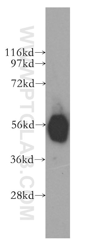 Western Blot (WB) analysis of human liver tissue using GLYCTK Polyclonal antibody (12426-1-AP)