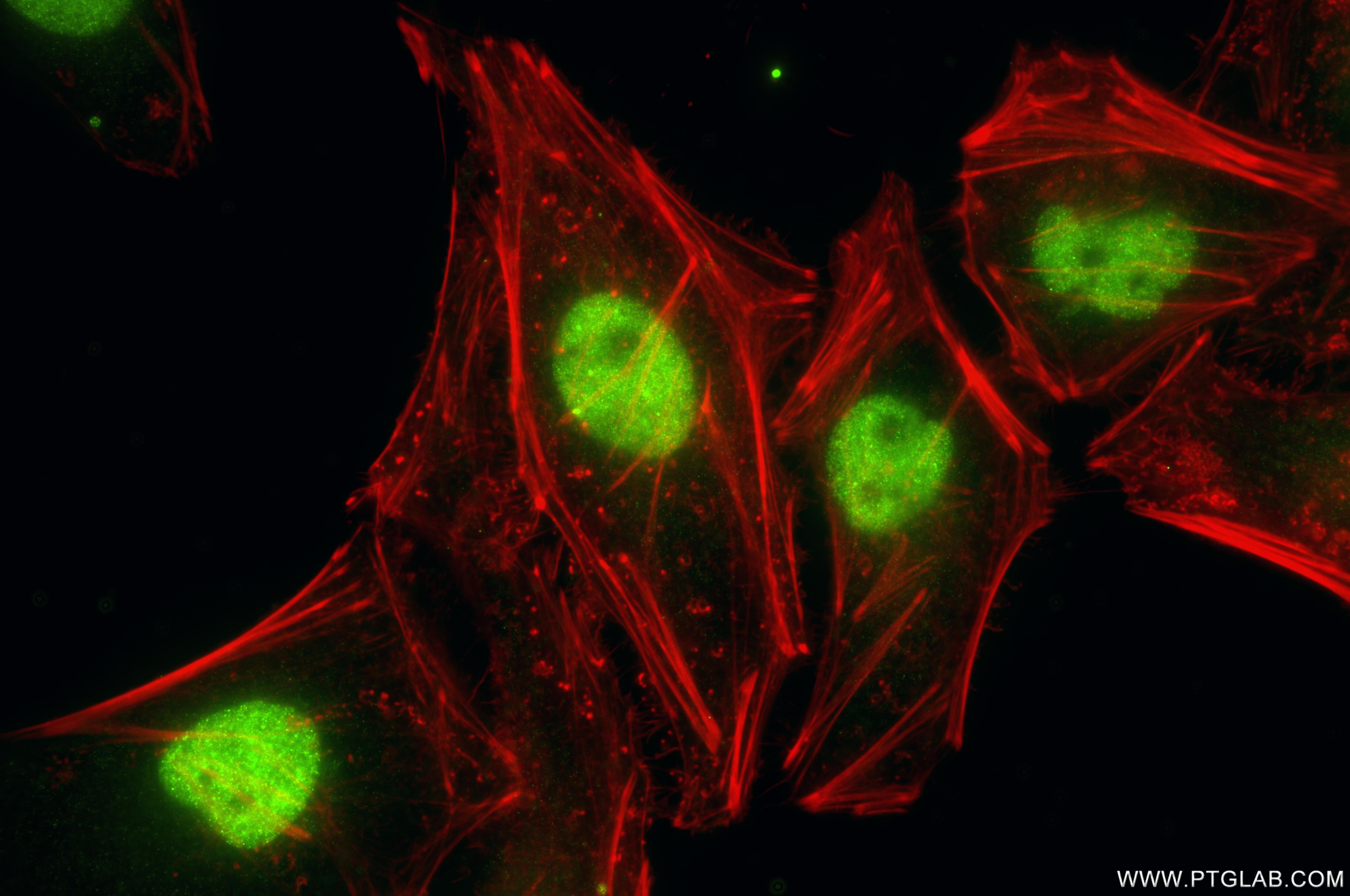 Immunofluorescence (IF) / fluorescent staining of HeLa cells using GLYR1 Recombinant monoclonal antibody (86877-1-RR)