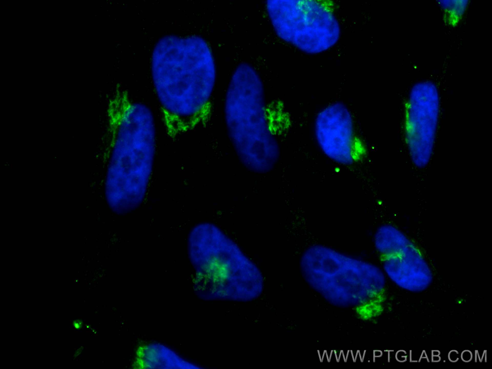 Immunofluorescence (IF) / fluorescent staining of HeLa cells using GOLGA2/GM130 Monoclonal antibody (66662-1-Ig)