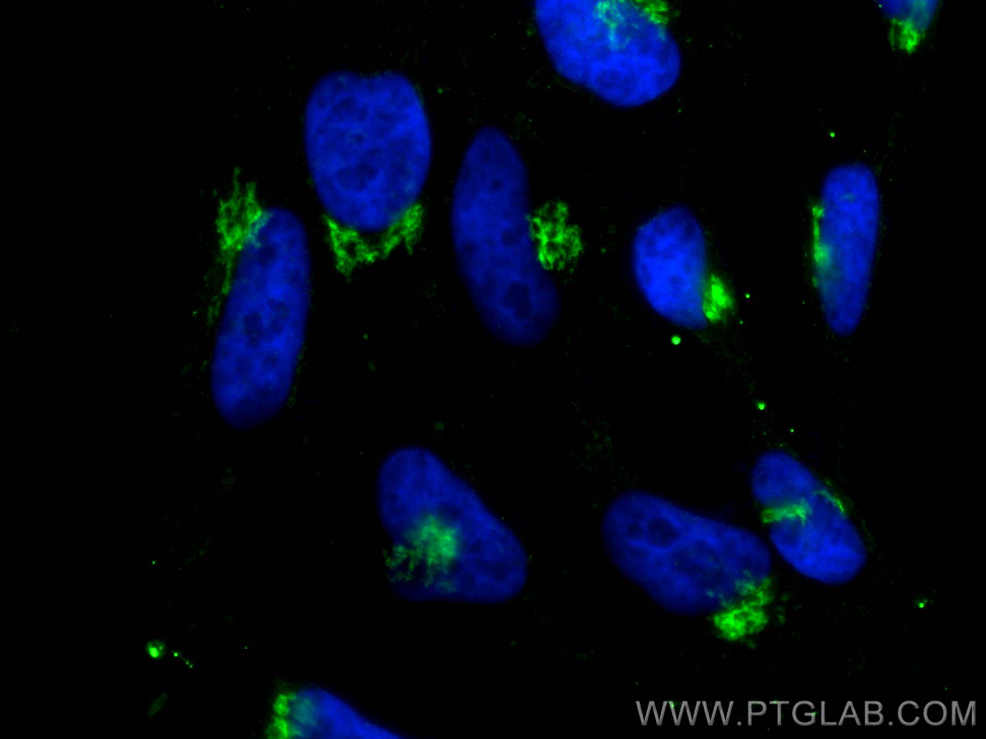 IF Staining of HeLa using 66662-1-Ig