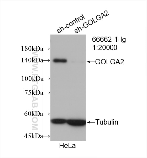 Western Blot (WB) analysis of HeLa cells using GOLGA2/GM130 Monoclonal antibody (66662-1-Ig)