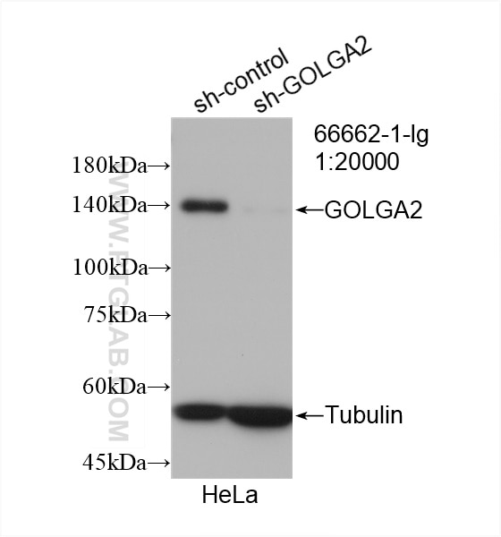 WB analysis of HeLa using 66662-1-Ig