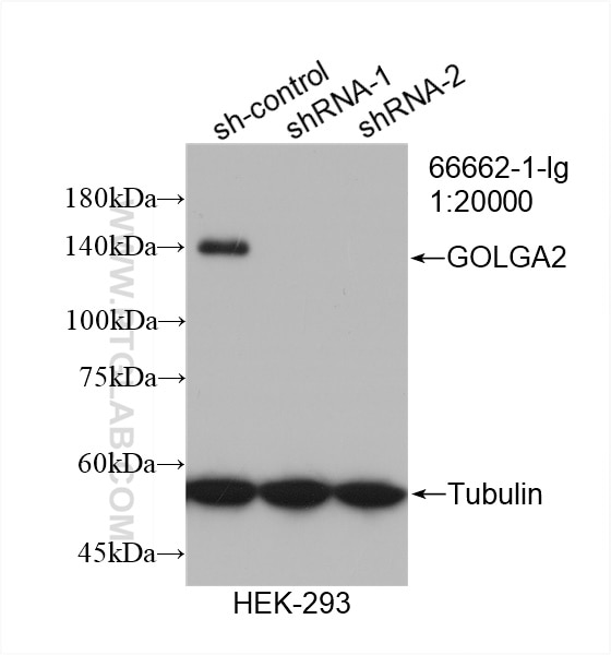 Western Blot (WB) analysis of HEK-293 cells using GOLGA2/GM130 Monoclonal antibody (66662-1-Ig)