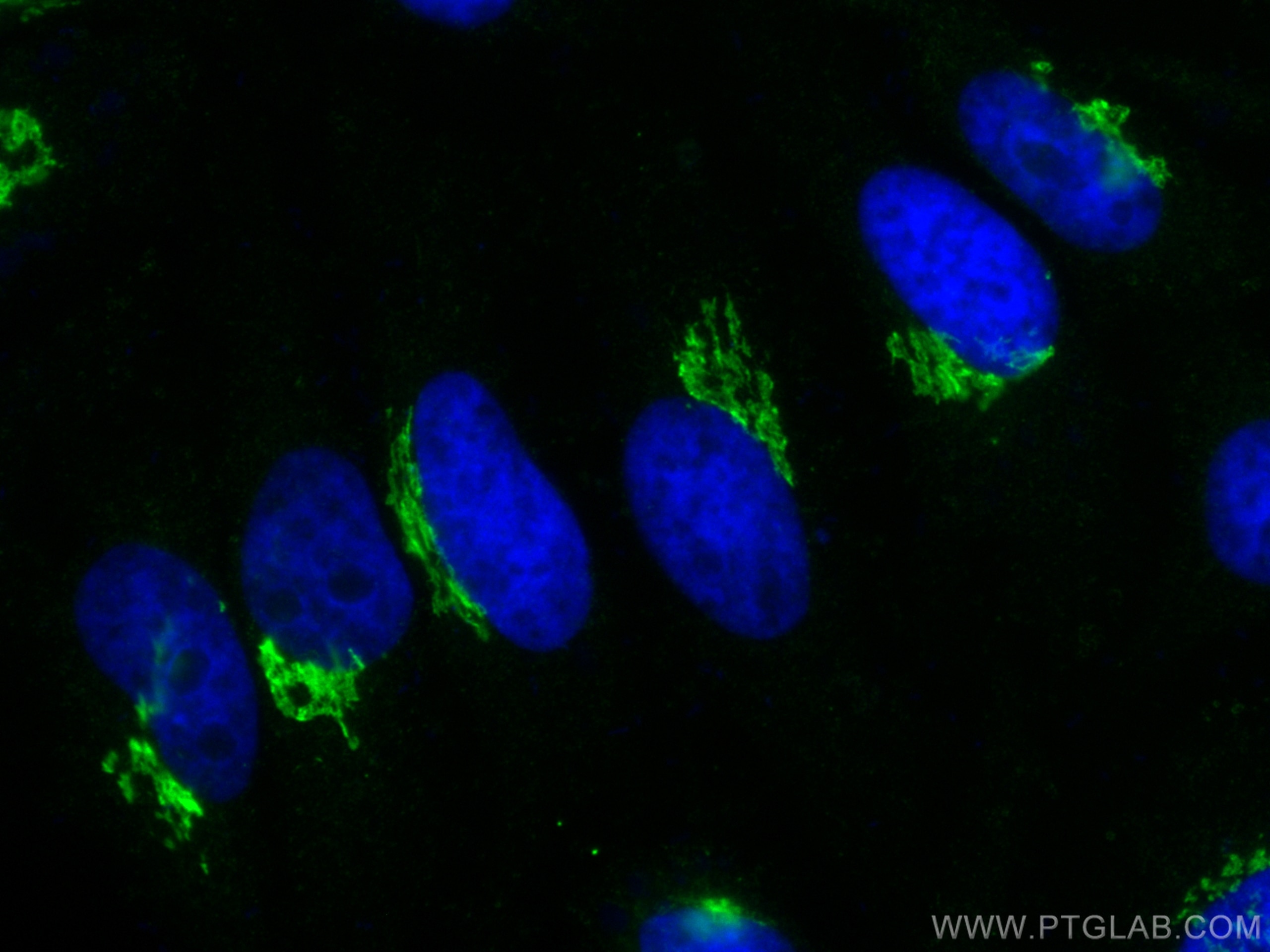 Immunofluorescence (IF) / fluorescent staining of HeLa cells using GM130;GOLGA2 Recombinant antibody (82705-8-RR)