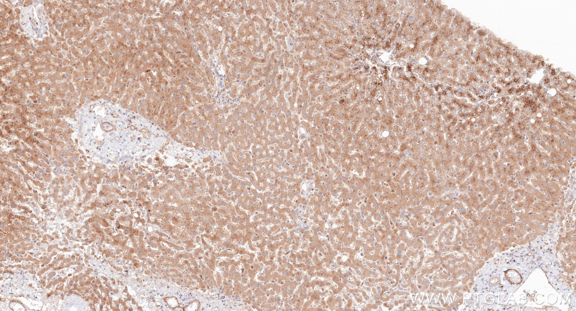 IHC staining of human liver using 82705-8-RR (same clone as 82705-8-PBS) Immunohistochemistry (IHC) staining of human liver tissue using GOLGA2/GM130 Recombinant monoclonal antibody (82705-8-RR)