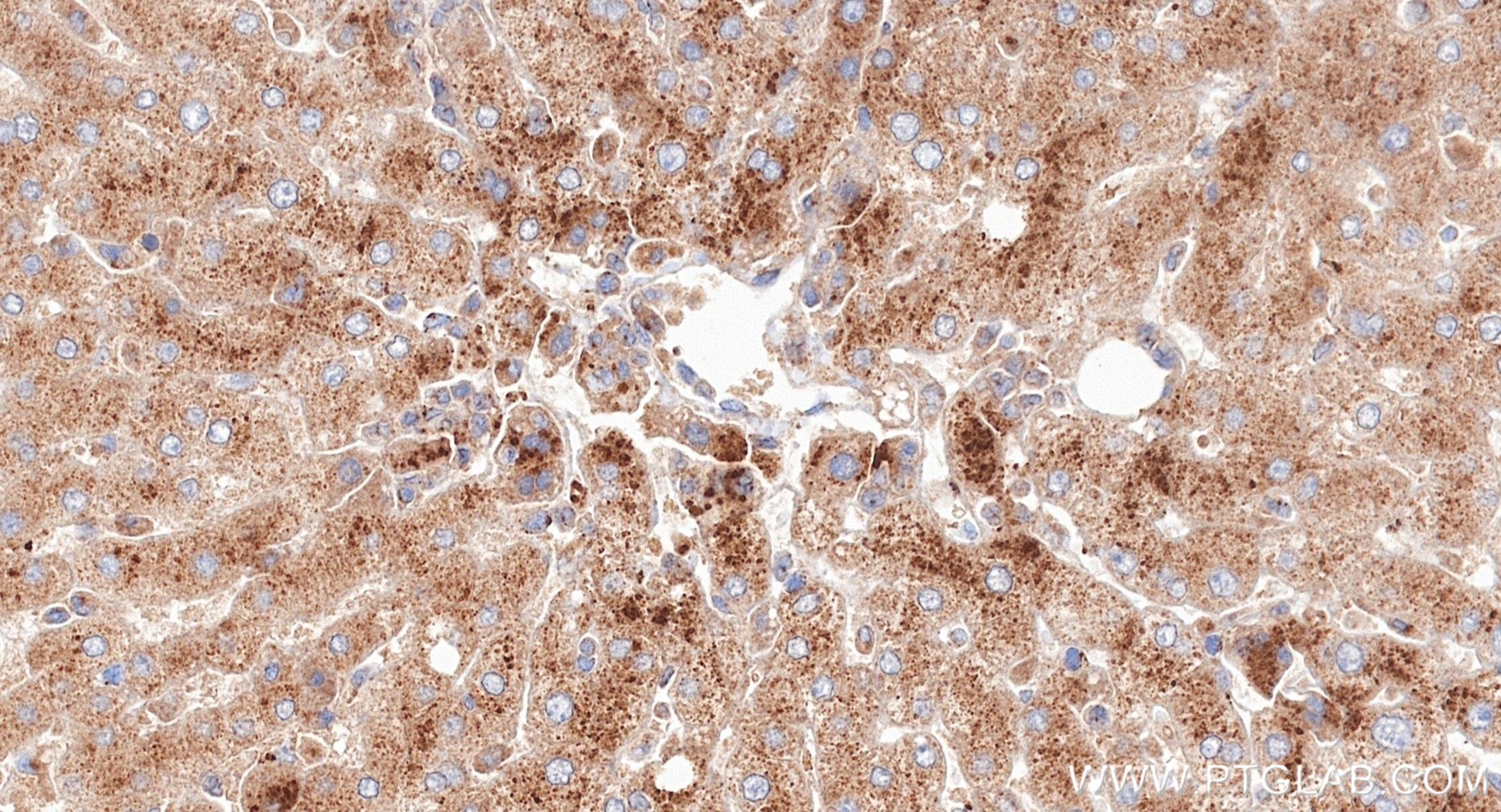 IHC staining of human liver using 82705-8-RR (same clone as 82705-8-PBS) Immunohistochemistry (IHC) staining of human liver tissue using GOLGA2/GM130 Recombinant monoclonal antibody (82705-8-RR)
