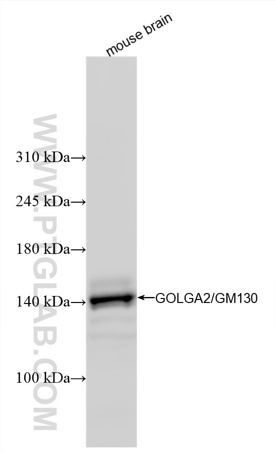 WB analysis using 82705-8-RR Western Blot (WB) analysis of various lysates using GOLGA2/GM130 Recombinant monoclonal antibody (82705-8-RR)