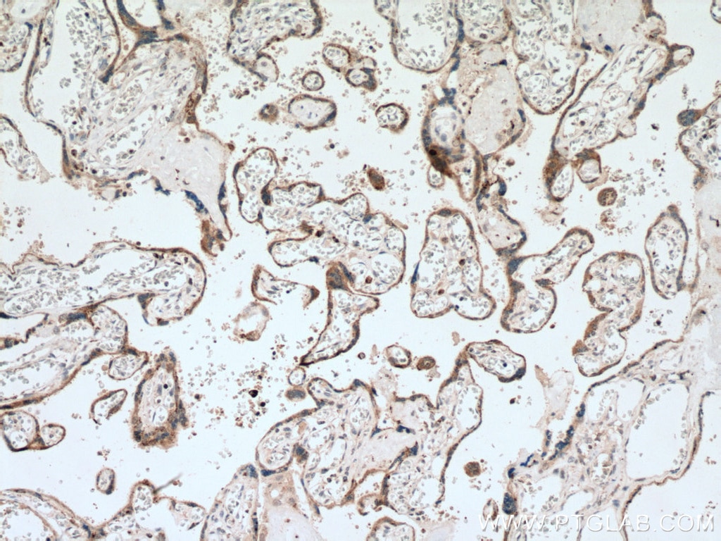 Immunohistochemistry (IHC) staining of human placenta tissue using GM2A Polyclonal antibody (10864-2-AP)