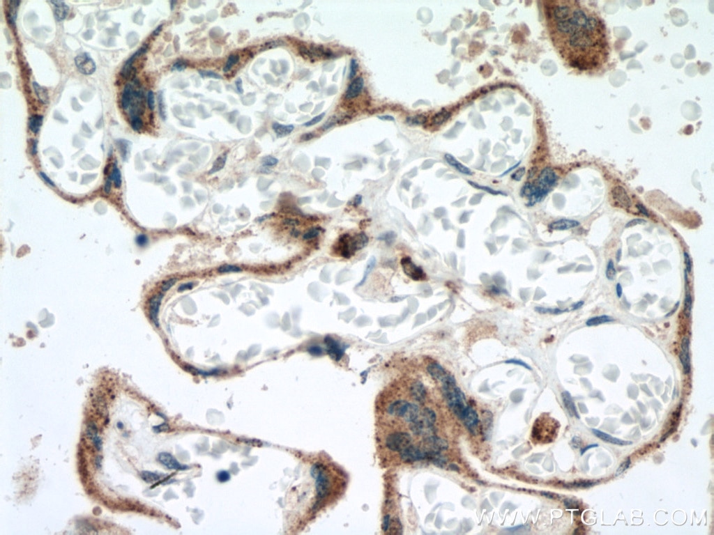 Immunohistochemistry (IHC) staining of human placenta tissue using GM2A Polyclonal antibody (10864-2-AP)