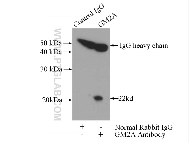 Immunoprecipitation (IP) experiment of HEK-293 cells using GM2A Polyclonal antibody (10864-2-AP)
