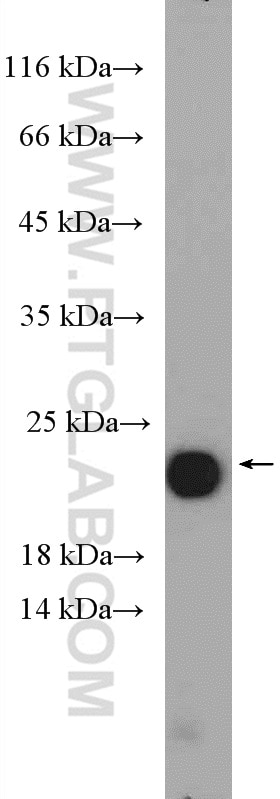 Western Blot (WB) analysis of rat kidney tissue using GM2A Polyclonal antibody (10864-2-AP)