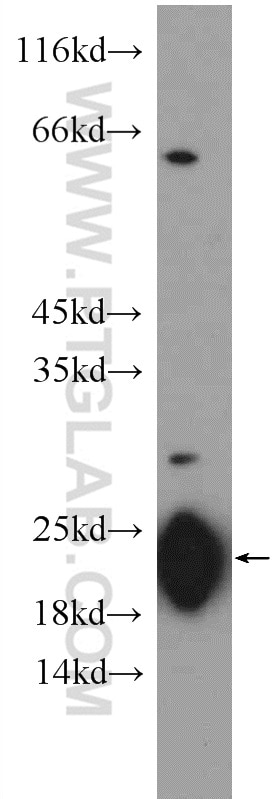 GM2A Polyclonal antibody