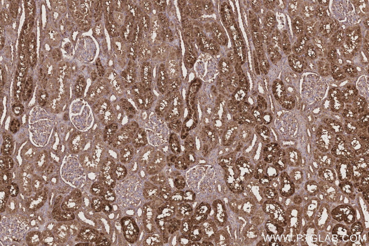 Immunohistochemistry (IHC) staining of human kidney tissue using GM2A Monoclonal antibody (66080-1-Ig)