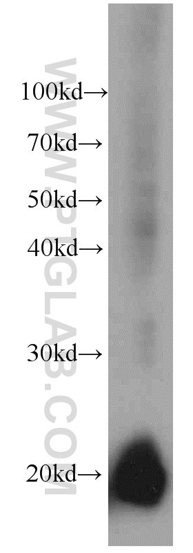 Western Blot (WB) analysis of human placenta tissue using GM2A Monoclonal antibody (66080-1-Ig)