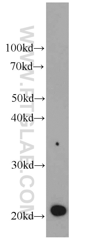 Western Blot (WB) analysis of HeLa cells using GM2A Monoclonal antibody (66080-1-Ig)