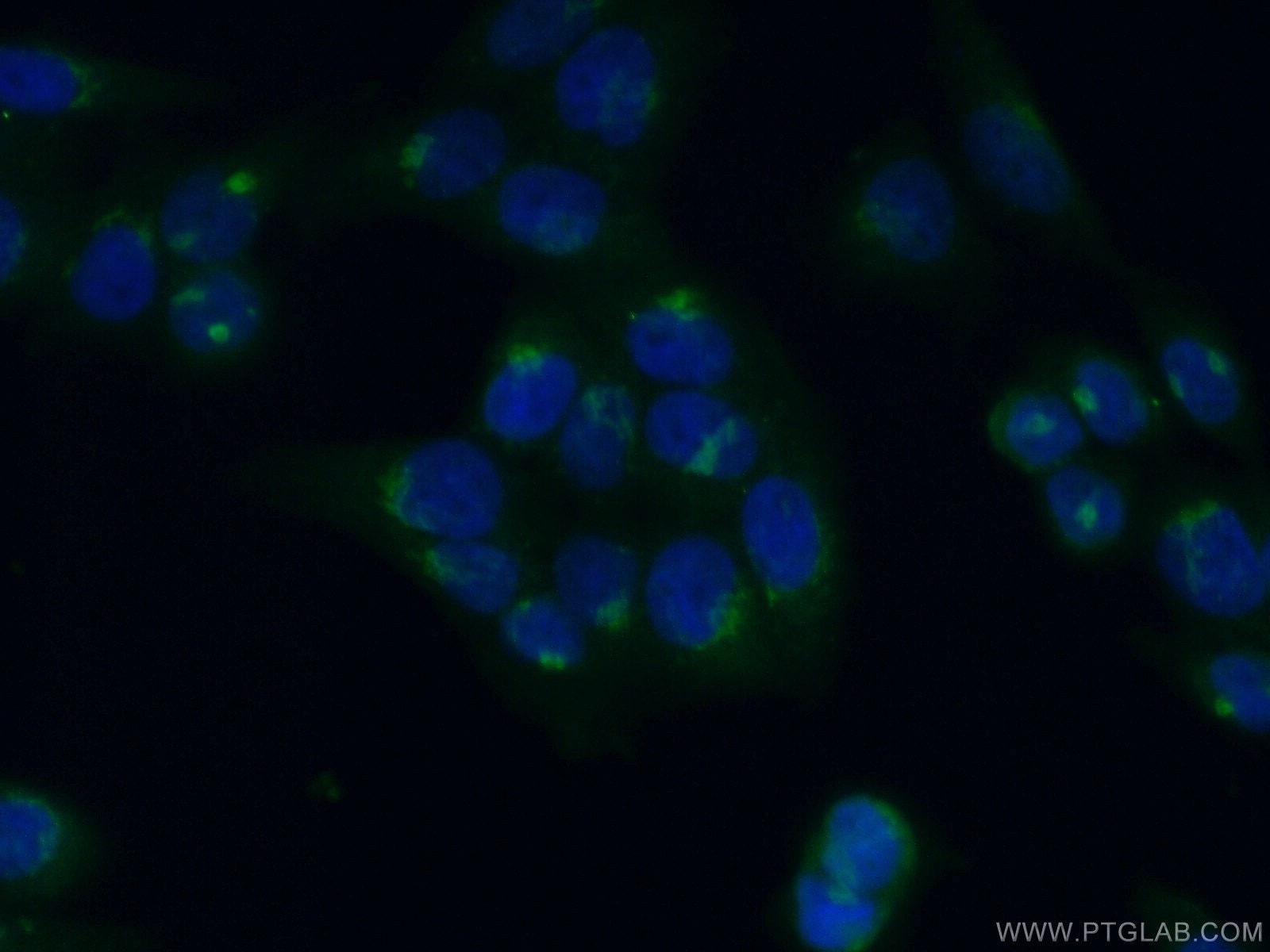 Immunofluorescence (IF) / fluorescent staining of HeLa cells using GMAP-210 Polyclonal antibody (26456-1-AP)