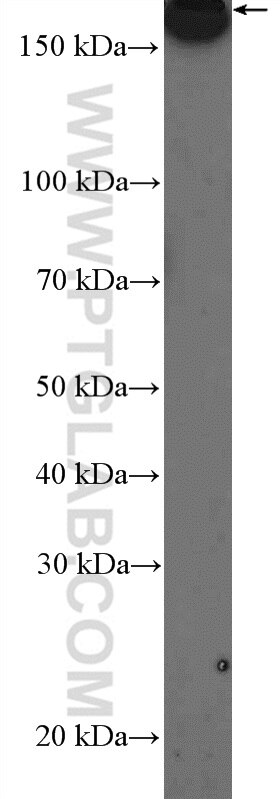 Western Blot (WB) analysis of HeLa cells using GMAP-210 Polyclonal antibody (26456-1-AP)