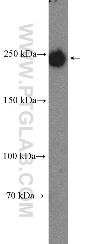 WB analysis of HL-60 using 26456-1-AP