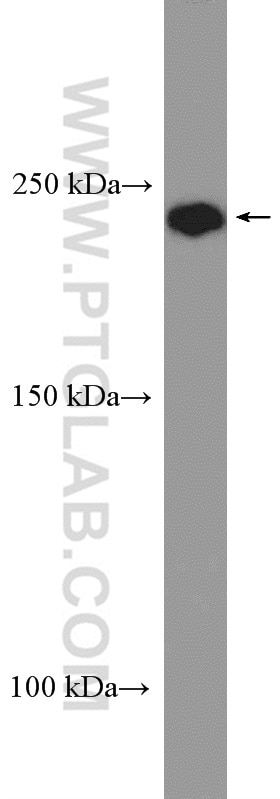 WB analysis of HL-60 using 26456-1-AP