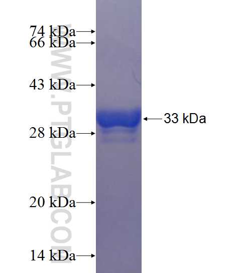 GMAP-210 fusion protein Ag13867 SDS-PAGE