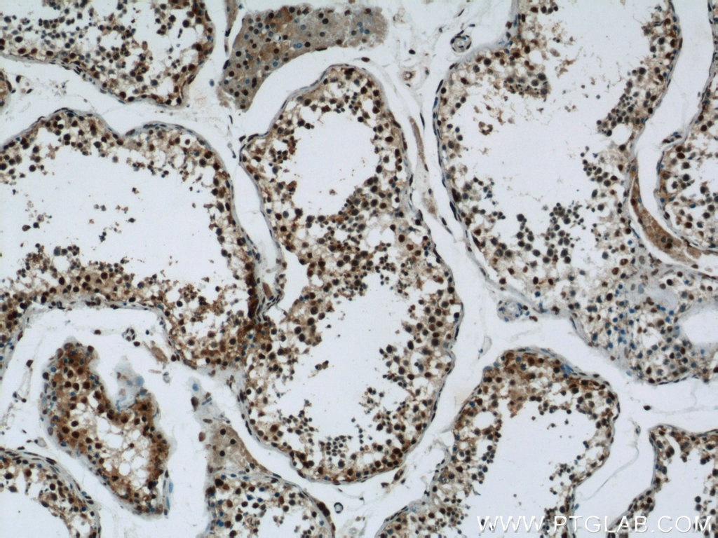 Immunohistochemistry (IHC) staining of human testis tissue using GMCL1 Polyclonal antibody (15575-1-AP)