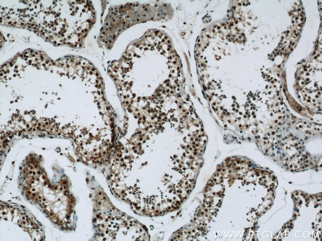 IHC staining of human testis using 15575-1-AP