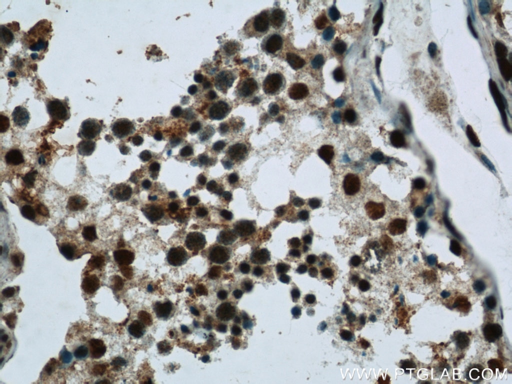 Immunohistochemistry (IHC) staining of human testis tissue using GMCL1 Polyclonal antibody (15575-1-AP)