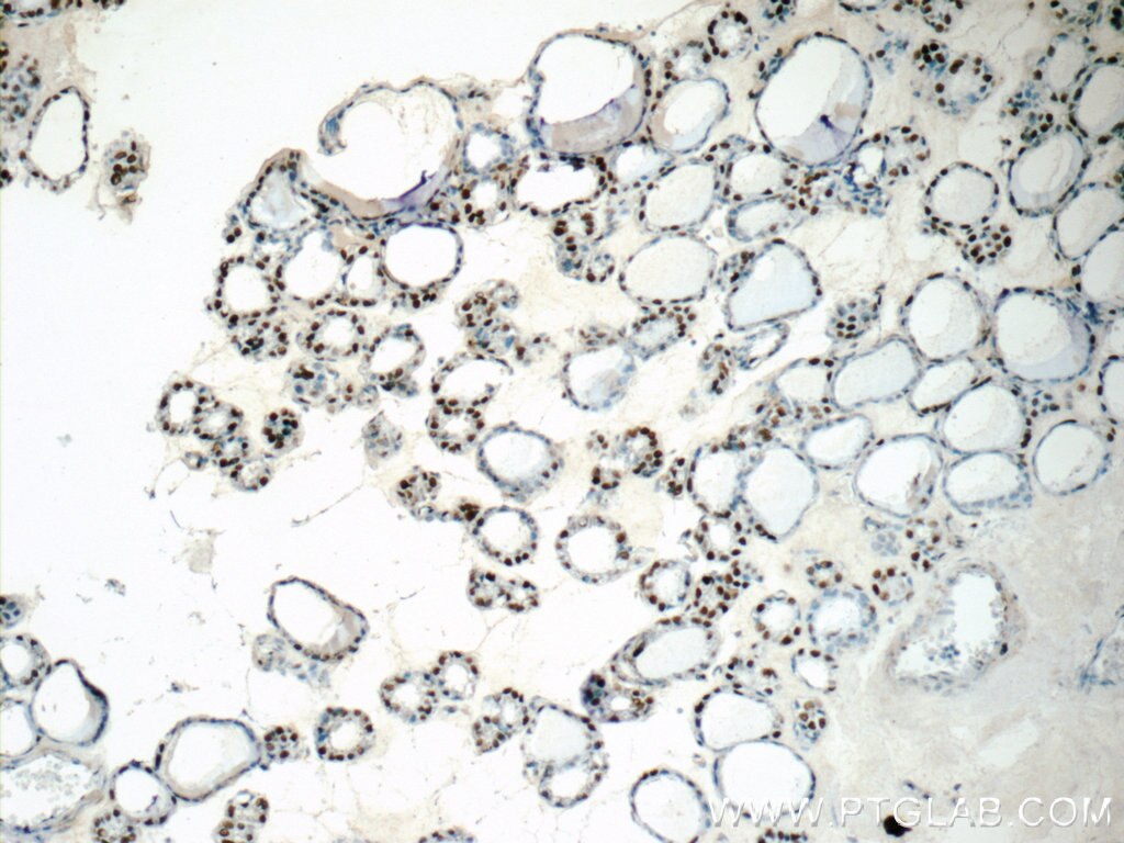 Immunohistochemistry (IHC) staining of human thyroid tissue using GMCL1 Polyclonal antibody (15575-1-AP)