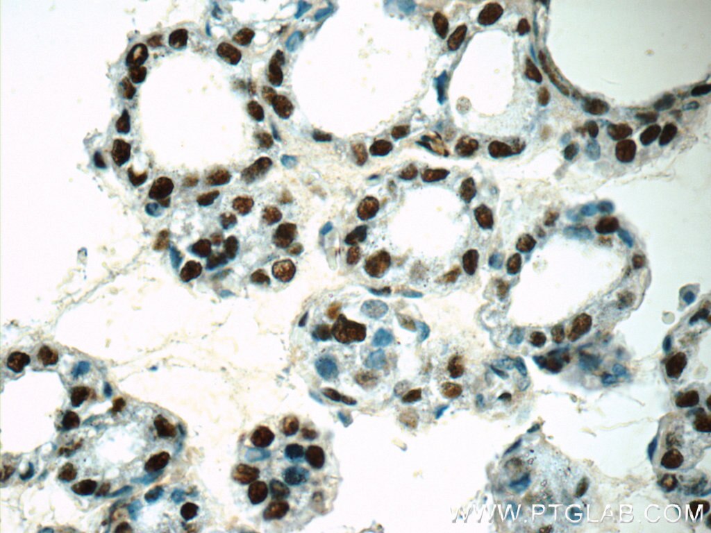 Immunohistochemistry (IHC) staining of human thyroid tissue using GMCL1 Polyclonal antibody (15575-1-AP)
