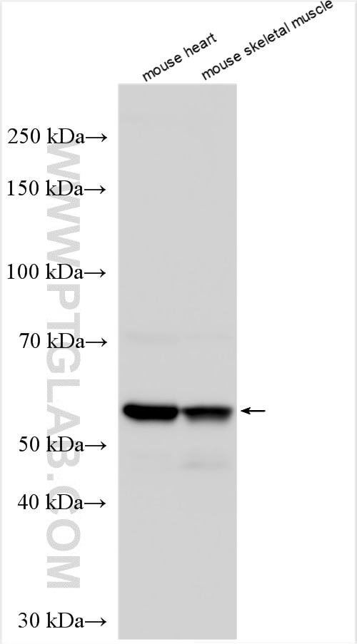 Western Blot (WB) analysis of various lysates using GMCL1 Polyclonal antibody (15575-1-AP)