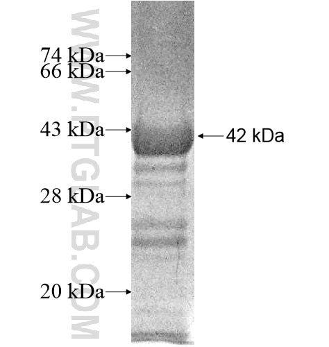 GMCL1L fusion protein Ag10631 SDS-PAGE