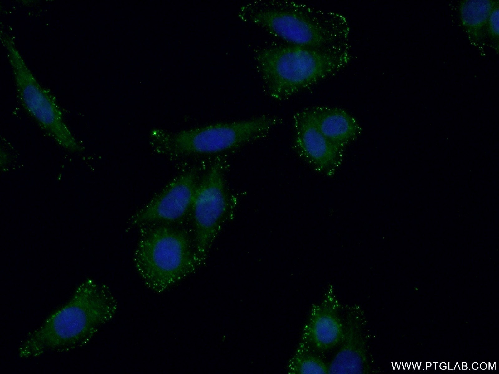 Immunofluorescence (IF) / fluorescent staining of HeLa cells using GMDS Polyclonal antibody (15442-1-AP)