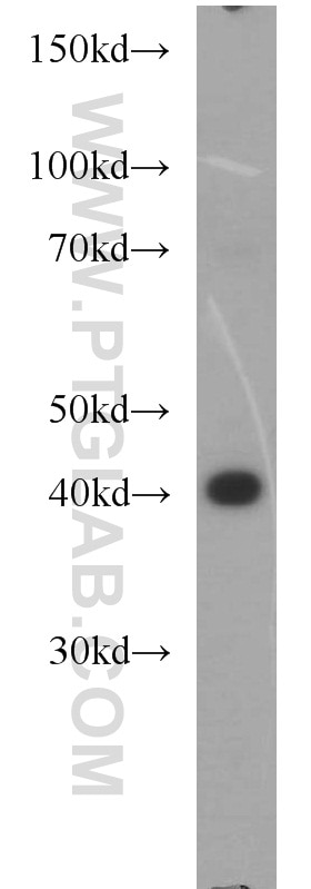Western Blot (WB) analysis of HeLa cells using GMDS Polyclonal antibody (15442-1-AP)