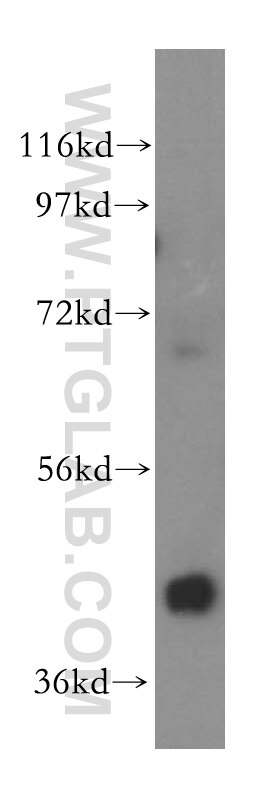 WB analysis of HeLa using 15442-1-AP