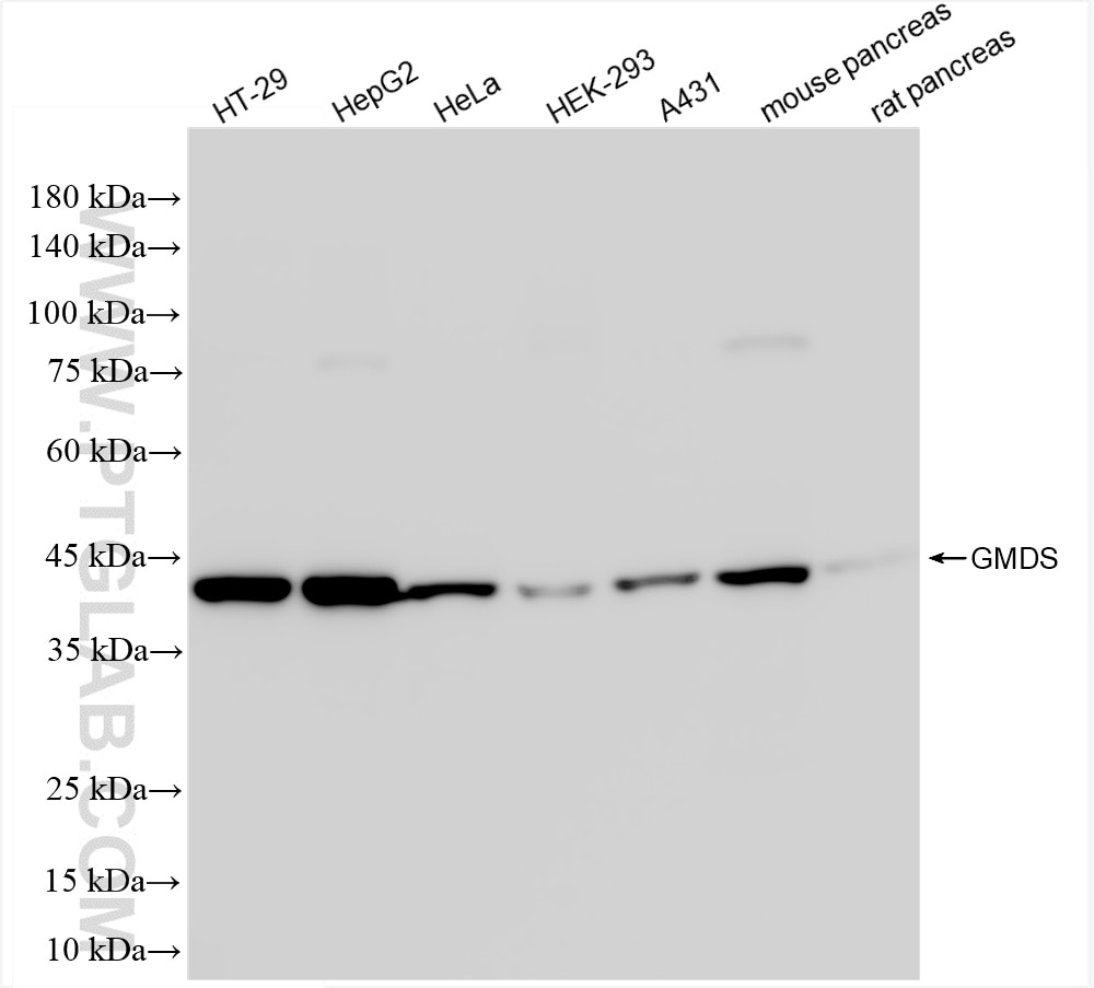 Western Blot (WB) analysis of various lysates using GMDS Recombinant antibody (86435-1-RR)