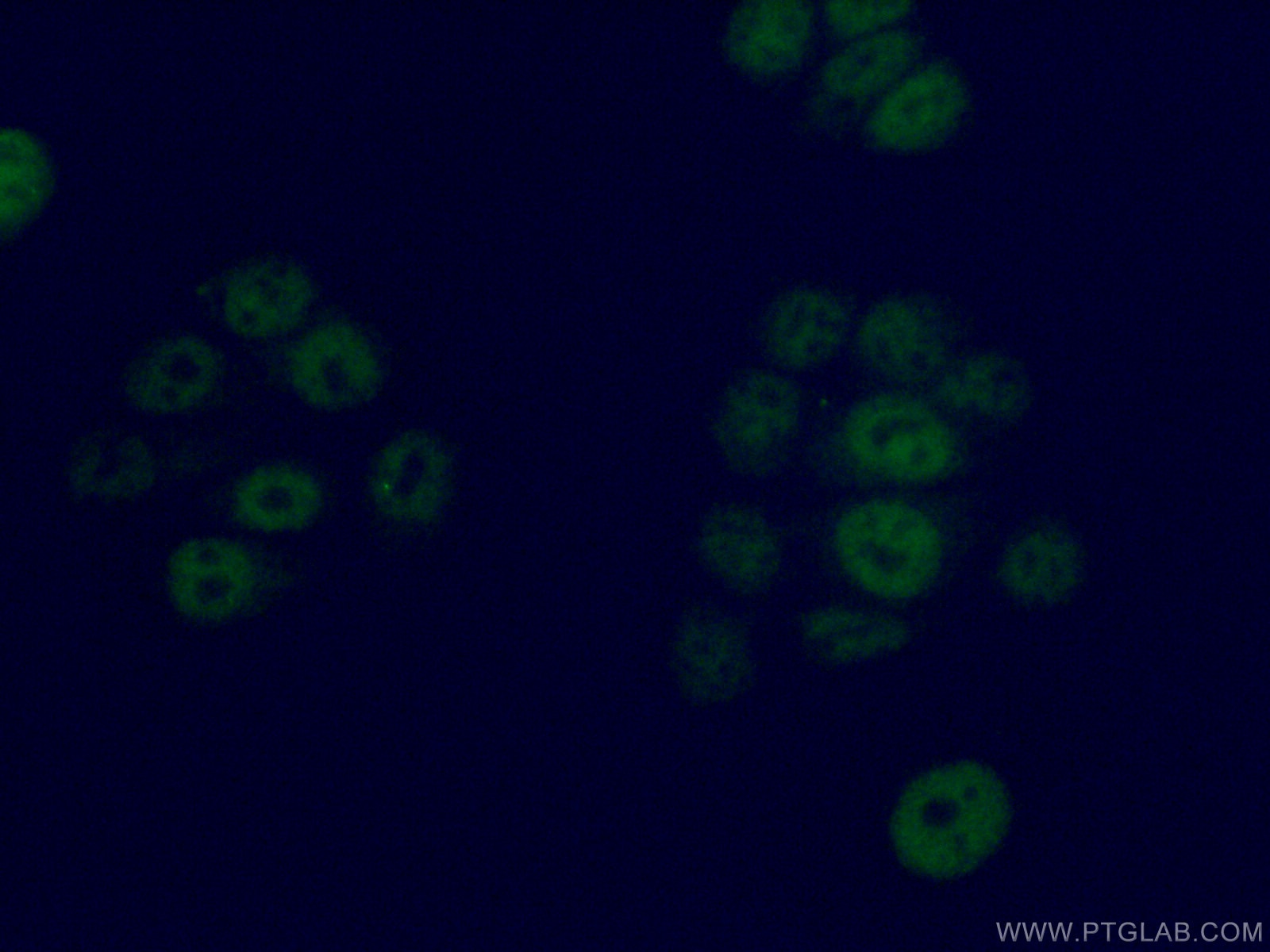 Immunofluorescence (IF) / fluorescent staining of MCF-7 cells using GMEB2 Polyclonal antibody (13314-1-AP)