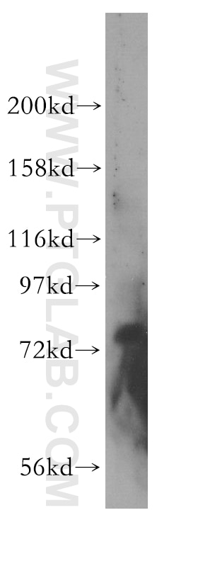 Western Blot (WB) analysis of mouse ovary tissue using GMEB2 Polyclonal antibody (13314-1-AP)