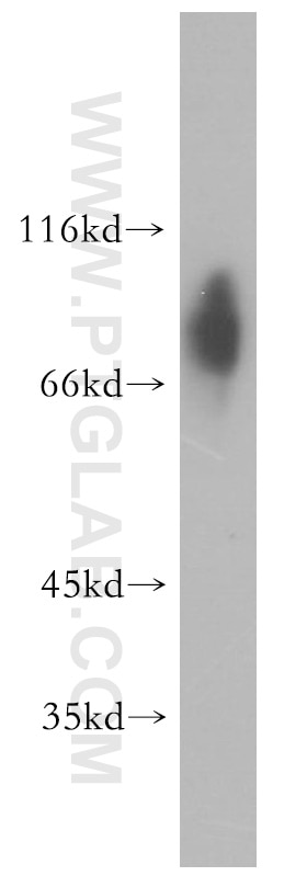 Western Blot (WB) analysis of human placenta tissue using GMEB2 Polyclonal antibody (13314-1-AP)